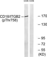 Integrin β2 (phospho Thr758) Polyclonal Antibody