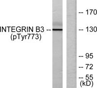 Integrin β3 (phospho Tyr773) Polyclonal Antibody