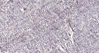 Intestinal Cell Kinase (phospho Tyr159) Polyclonal Antibody