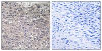 IP3R-I (phospho Ser1598) Polyclonal Antibody