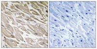 IPP-2 (phospho Ser120/S121) Polyclonal Antibody