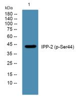 IPP-2 (phospho Ser44) Polyclonal Antibody