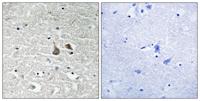 IRAK-1 (phospho Ser376) Polyclonal Antibody