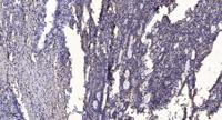 IRAK-1 (phospho Thr387) Polyclonal Antibody