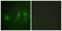 IRF-3 (phospho Ser385) Polyclonal Antibody