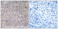 IRP-1 (phospho Ser711) Polyclonal Antibody