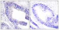 IRS-1 (phospho Ser1101) Polyclonal Antibody