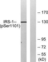 IRS-1 (phospho Ser1101) Polyclonal Antibody