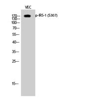 IRS-1 (phospho Ser307) Polyclonal Antibody