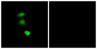 IRS-1 (phospho Ser307) Polyclonal Antibody