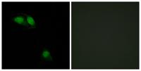 IRS-1 (phospho Ser312) Polyclonal Antibody