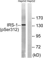 IRS-1 (phospho Ser312) Polyclonal Antibody