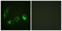 IRS-1 (phospho Ser323) Polyclonal Antibody