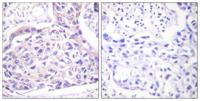 IRS-1 (phospho Ser323) Polyclonal Antibody