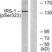 IRS-1 (phospho Ser323) Polyclonal Antibody