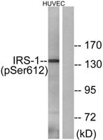 IRS-1 (phospho Ser616) Polyclonal Antibody