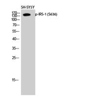 IRS-1 (phospho Ser636) Polyclonal Antibody