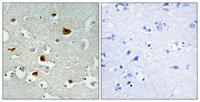 IRS-1 (phospho Ser636) Polyclonal Antibody