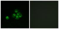 IRS-1 (phospho Ser636) Polyclonal Antibody