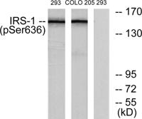 IRS-1 (phospho Ser636) Polyclonal Antibody