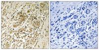 IRS-1 (phospho Ser639) Polyclonal Antibody