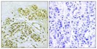 IκB-α (phospho Tyr42) Polyclonal Antibody