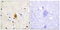 Krs-1/2 (phospho Thr183) Polyclonal Antibody