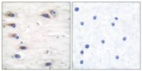 Ksr-1 (phospho Ser392) Polyclonal Antibody