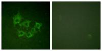 Cot (phospho Thr290) Polyclonal Antibody