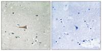 DDR1 (phospho Tyr513) Polyclonal Antibody