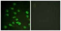DDX3 (phospho Thr322) Polyclonal Antibody