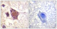 DDX3 (phospho Thr322) Polyclonal Antibody
