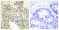 Desmin (phospho Ser60) Polyclonal Antibody