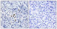 Plk (phospho Thr210) Polyclonal Antibody