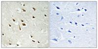 GRF-1 (phospho Tyr1105) Polyclonal Antibody
