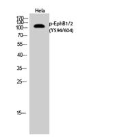 EphB1/2 (phospho Tyr594/604) Polyclonal Antibody