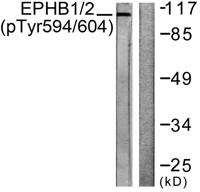 EphB1/2 (phospho Tyr594/604) Polyclonal Antibody