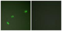 B23 (phospho Thr199) Polyclonal Antibody