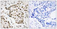 B23 (phospho Thr199) Polyclonal Antibody