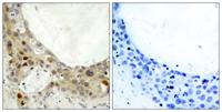 Bcl-2 (phospho Ser70) Polyclonal Antibody