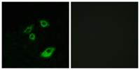 Bcl-2 (phospho Thr56) Polyclonal Antibody