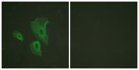 Bcl-2 (phospho Thr69) Polyclonal Antibody