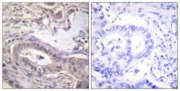 Bcl-x (phospho Thr47) Polyclonal Antibody