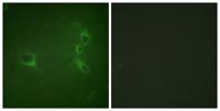 Bcr (phospho Tyr360) Polyclonal Antibody