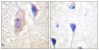 Bcr (phospho Tyr360) Polyclonal Antibody