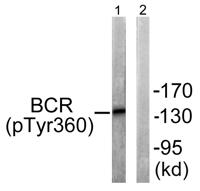 Bcr (phospho Tyr360) Polyclonal Antibody