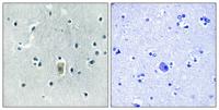 Bim (phospho Ser59) Polyclonal Antibody