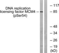 MCM4 (phospho Ser54) Polyclonal Antibody