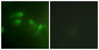 MDM2 (phospho Ser186/S188) Polyclonal Antibody