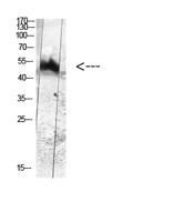 MDM2 (Phospho Tyr394) Antibody